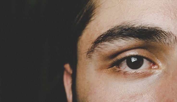 Trafik Kazası Göz Kaybı Tazminatı